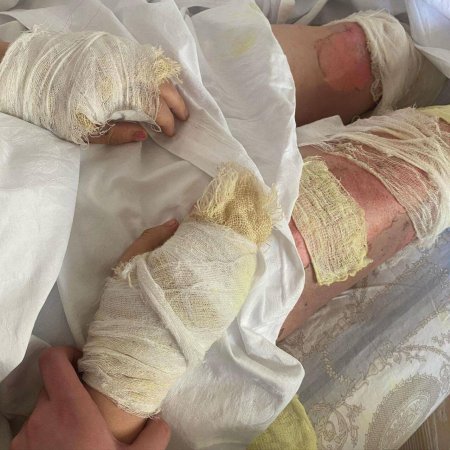 Bloger Aysel partlayışdan sonra - FOTO
