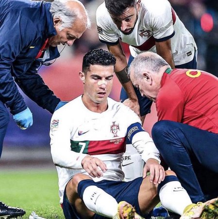 Ronaldo son oyunda ciddi zədə alıb.FOTO