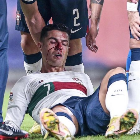 Ronaldo son oyunda ciddi zədə alıb.FOTO