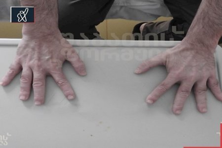 Saakaşvili tanınmaz halda — Müalicə aldığı xəstəxanadan FOTOLARI